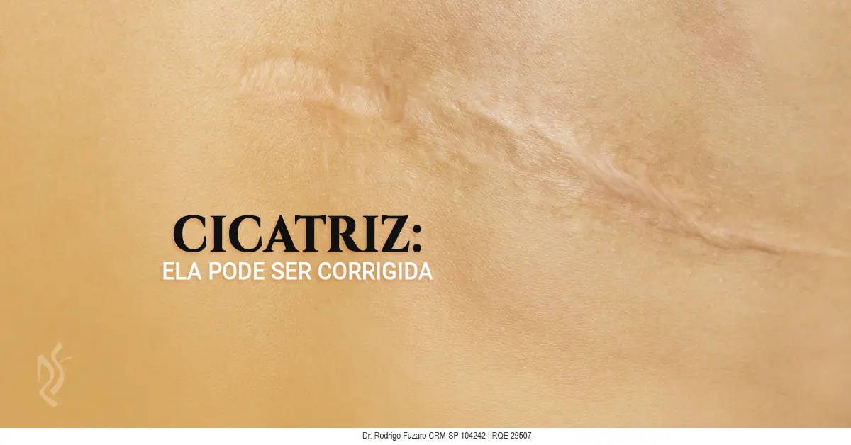 Correção de cicatriz — atrófica, hipertrófica e queloide