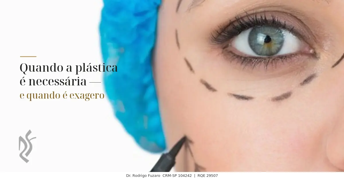Quando a plástica é necessária — e quando é exagero